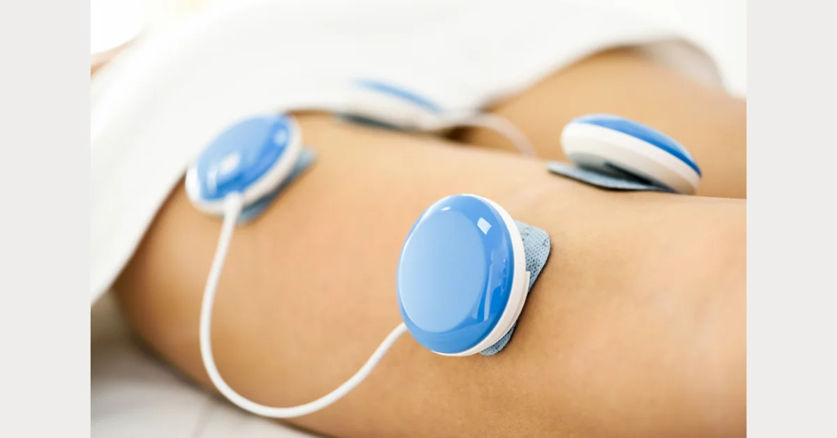 image of Transcutaneous Electrical Nerve Stimulation TENS